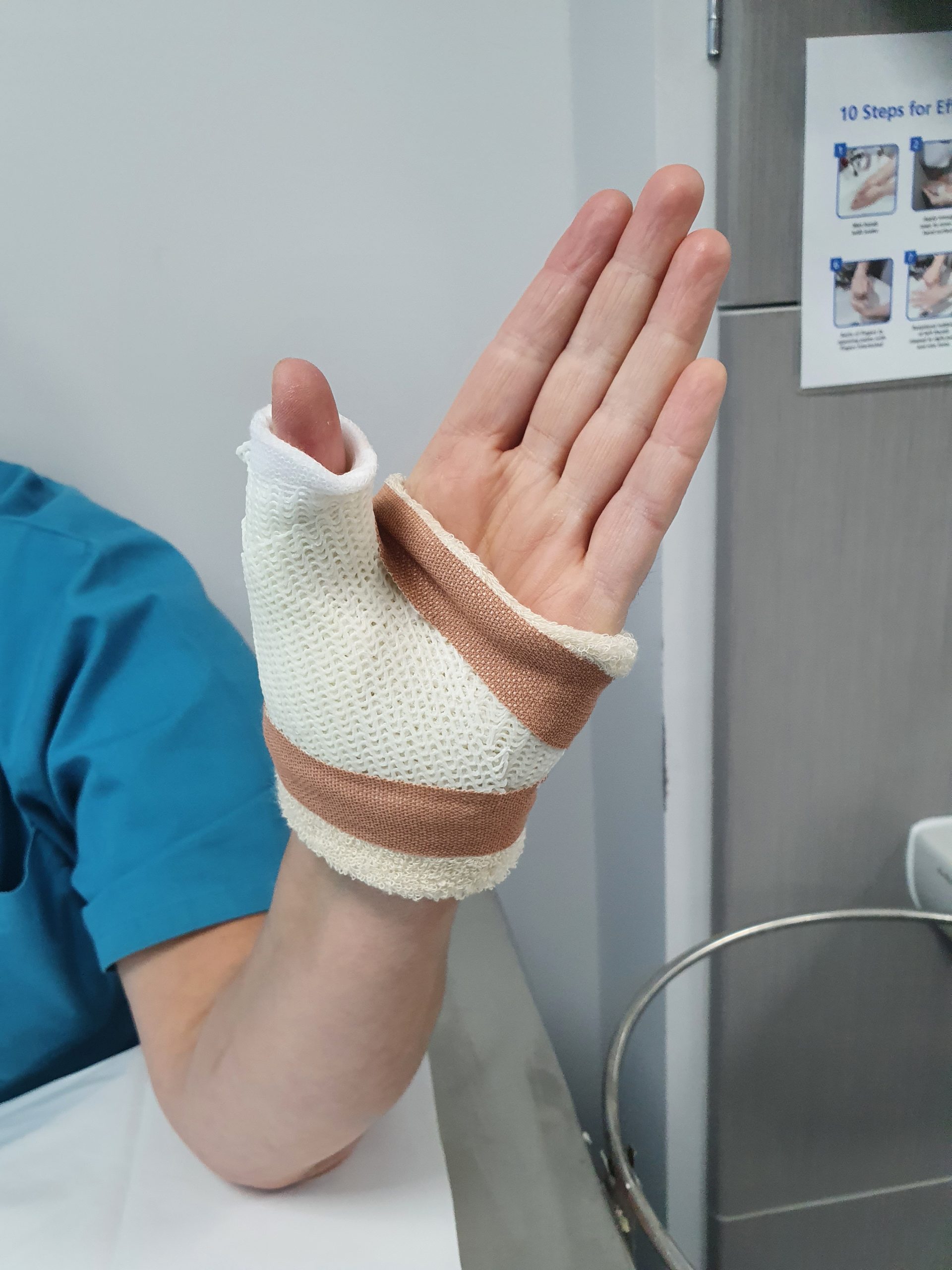 Thumb Spica Plaster Room 